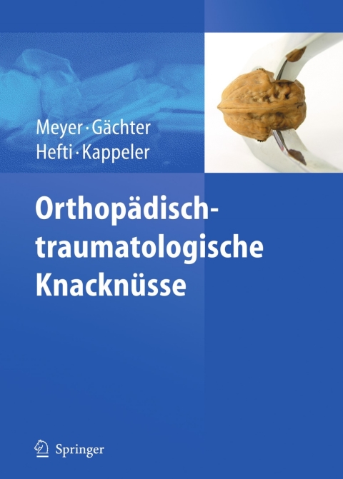 Cover image for book Orthopädisch-traumatologische Knacknüsse