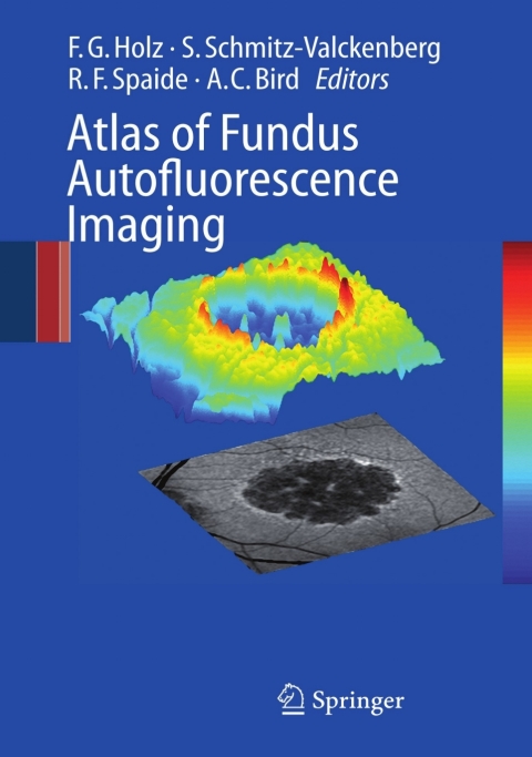 Cover image for book Atlas of Fundus Autofluorescence Imaging
