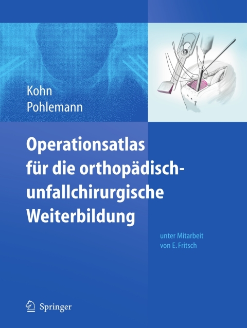 Cover image for book Operationsatlas für die orthopädisch-unfallchirurgische Weiterbildung