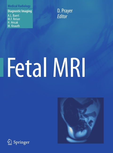 Cover image for book Fetal MRI