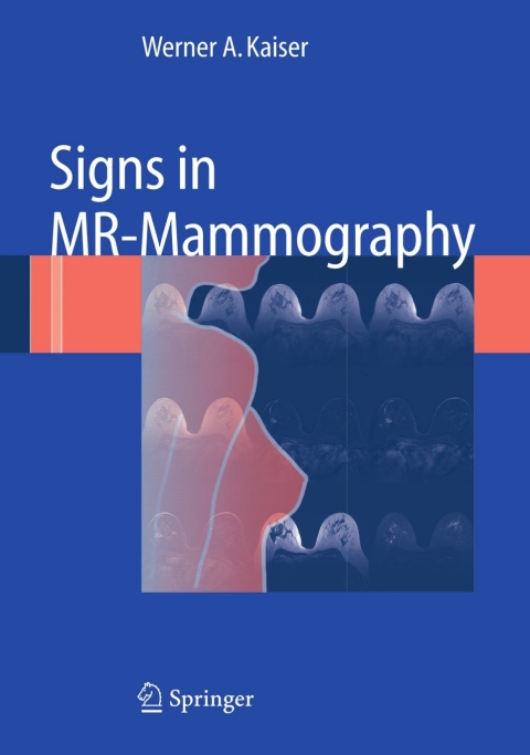 Cover image for book Signs in MR-Mammography