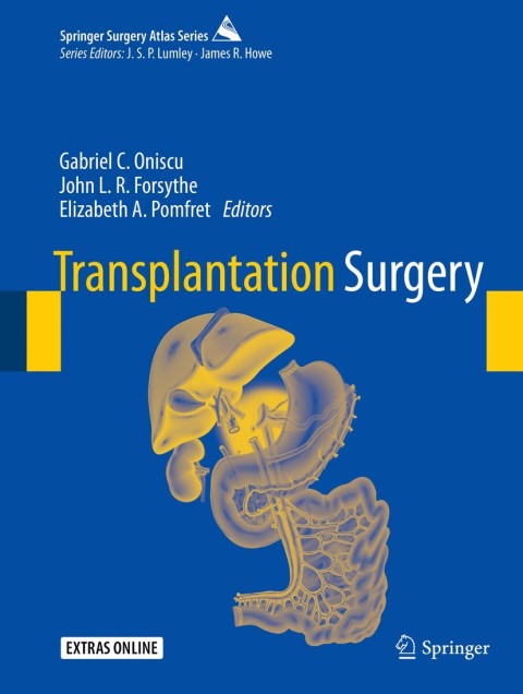 Cover image for book Transplantation Surgery