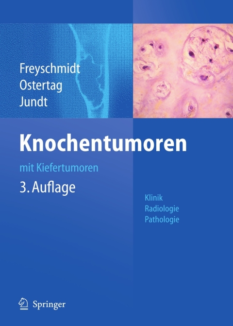 Cover image for book Knochentumoren mit Kiefertumoren