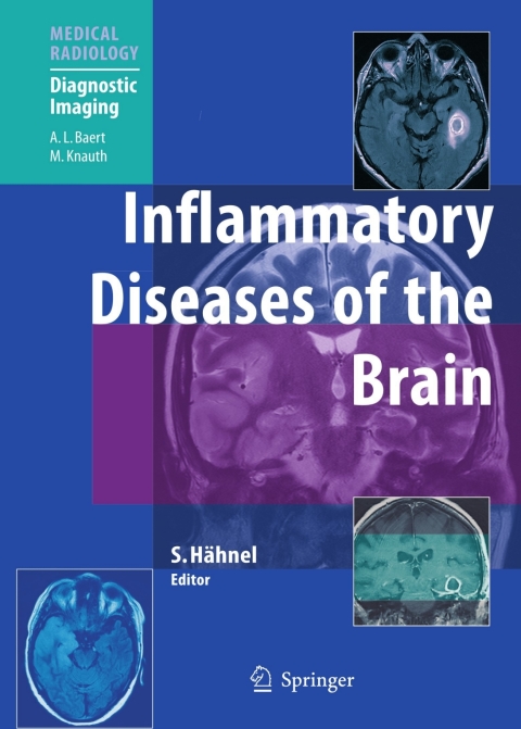 Cover image for book Inflammatory Diseases of the Brain