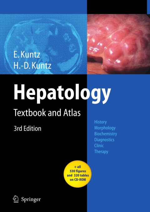 Cover image for book Hepatology
