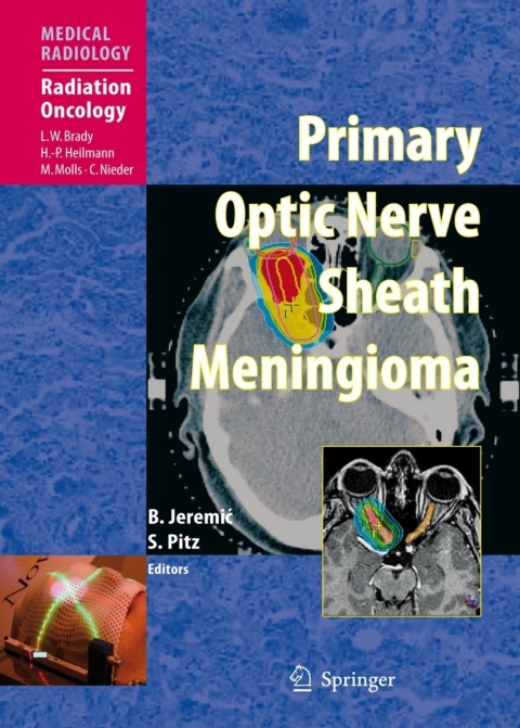 Cover image for book Primary Optic Nerve Sheath Meningioma