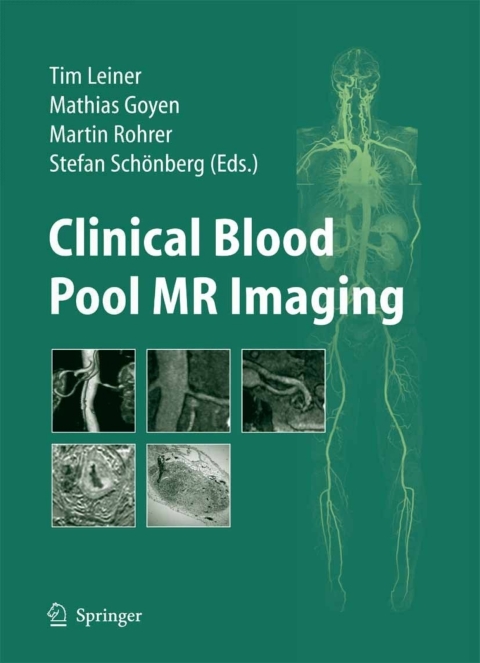 Cover image for book Clinical Blood Pool MR Imaging