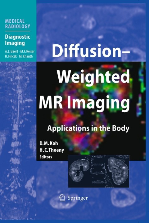 Cover image for book Diffusion-Weighted MR Imaging
