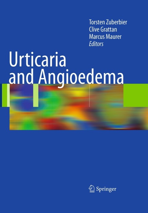 Cover image for book Urticaria and Angioedema