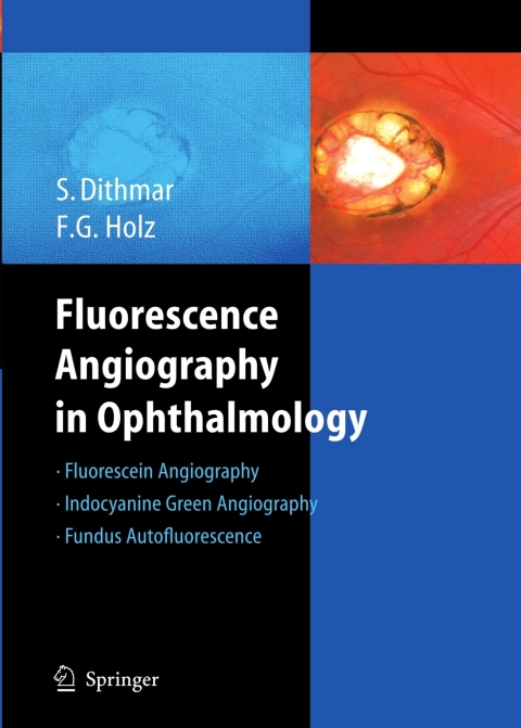 Cover image for book Fluorescence Angiography in Ophthalmology