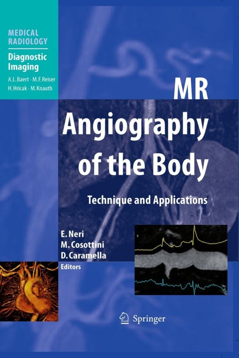 Cover image for book MR Angiography of the Body