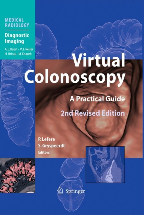 Cover image for book Virtual Colonoscopy