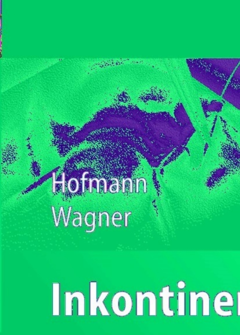 Cover image for book Inkontinenz- und Deszensuschirurgie der Frau