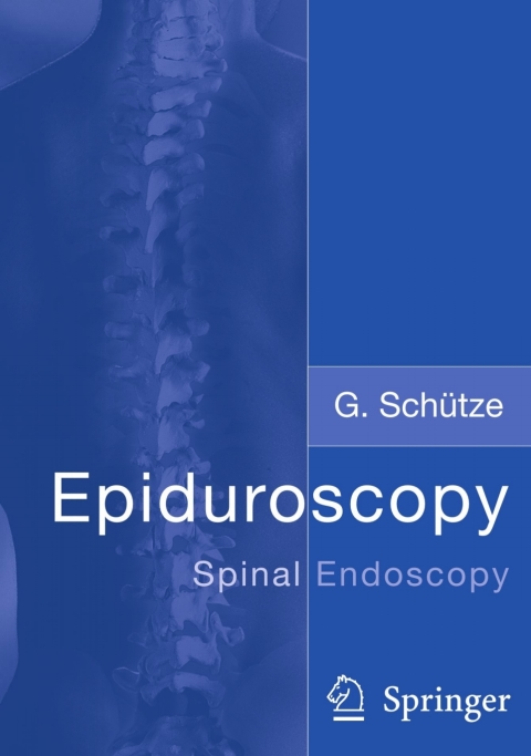 Cover image for book Epiduroscopy