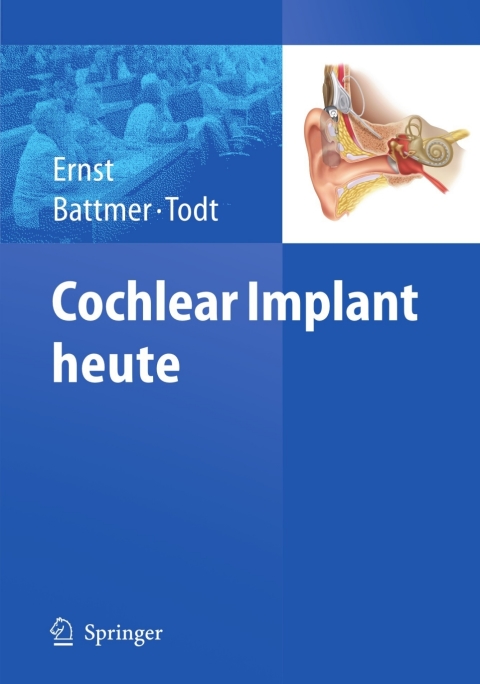 Cochlear Implant heute 