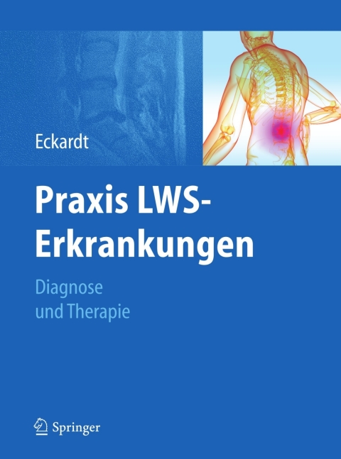 Cover image for book Praxis LWS-Erkrankungen