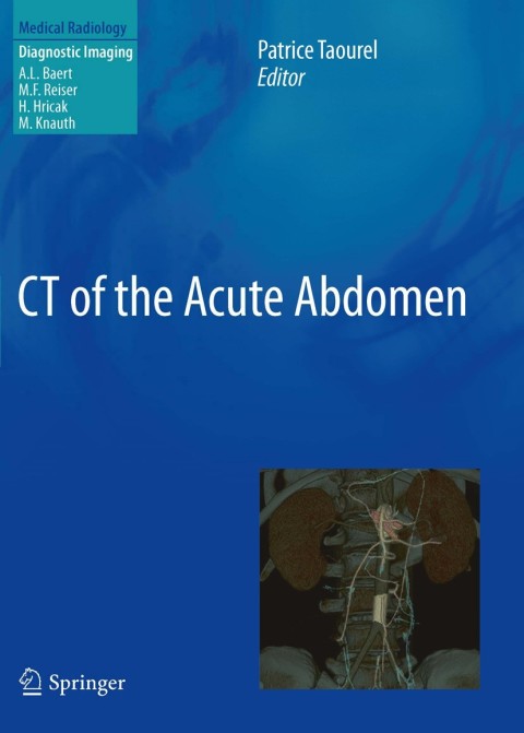 Cover image for book CT of the Acute Abdomen