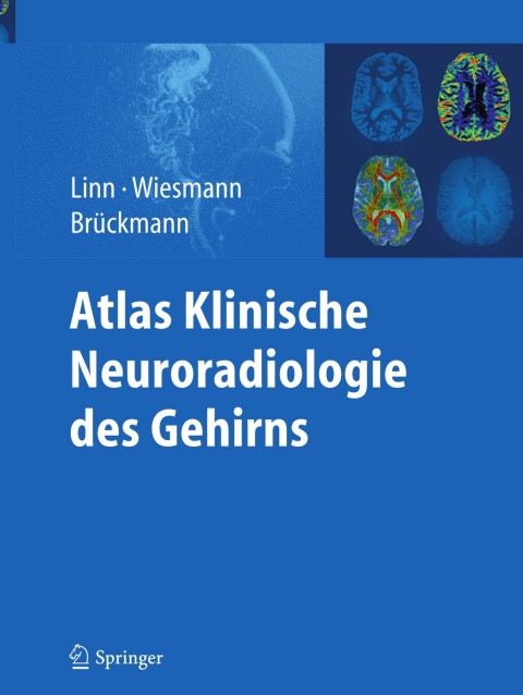 Cover image for book Atlas Klinische Neuroradiologie des Gehirns