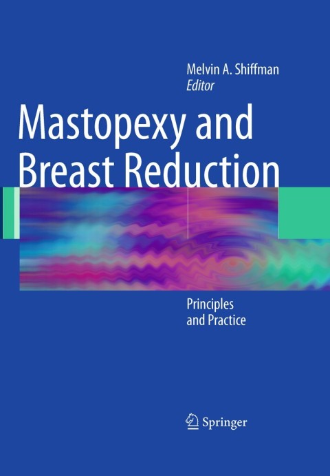 Cover image for book Mastopexy and Breast Reduction