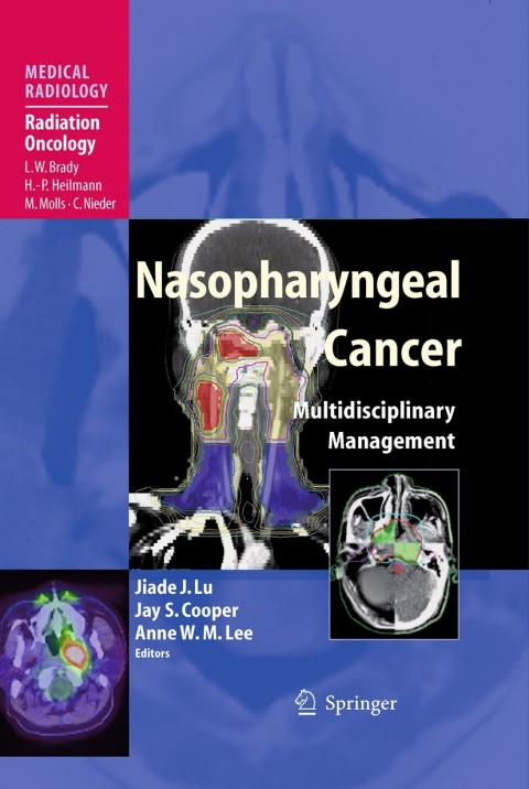 Cover image for book Nasopharyngeal Cancer