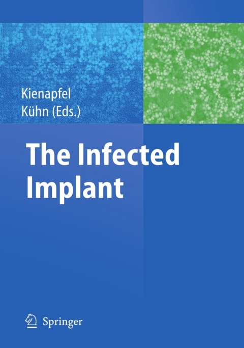 Cover image for book The Infected Implant