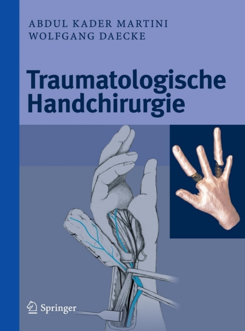 Cover image for book Traumatologische Handchirurgie