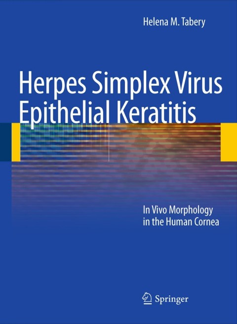 Cover image for book Herpes Simplex Virus Epithelial Keratitis