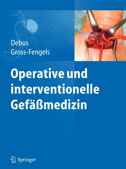 Cover image for book Operative und interventionelle Gefäßmedizin