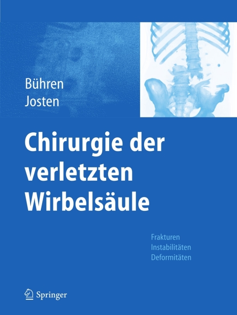 Cover image for book Chirurgie der verletzten Wirbelsäule