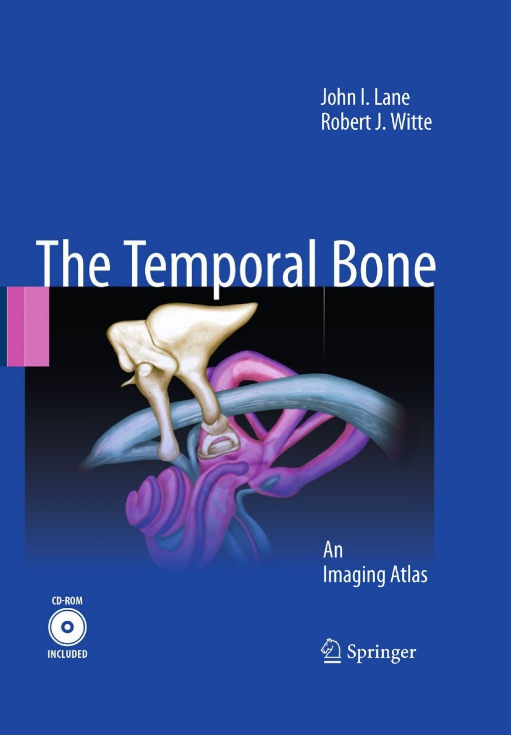 Temporal Bone (eBook)