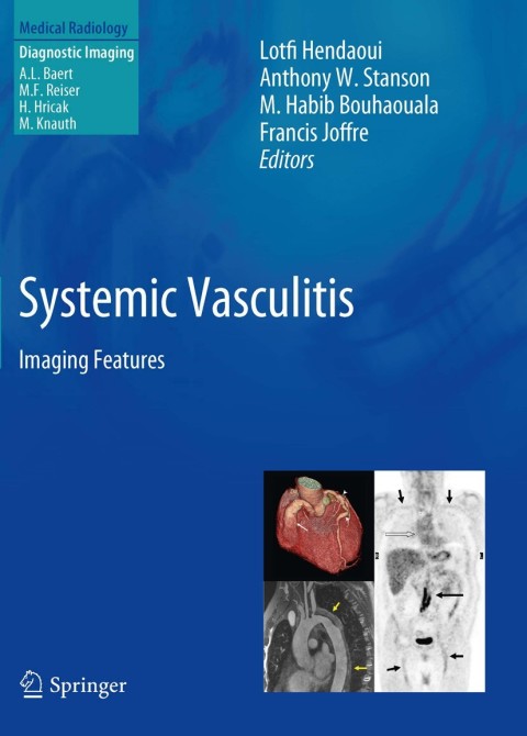 Cover image for book Systemic Vasculitis