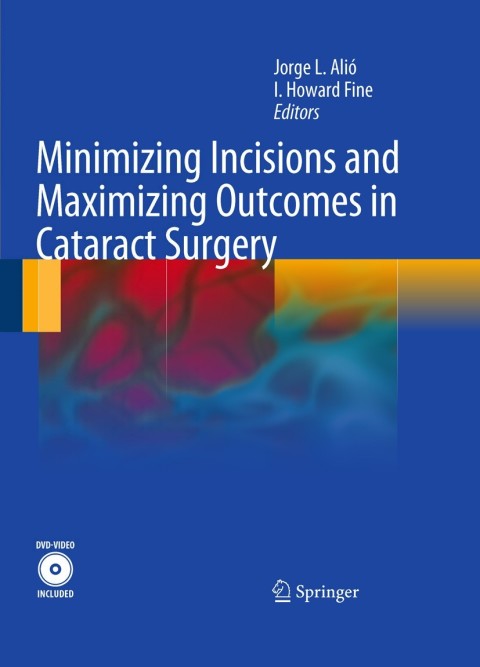 Cover image for book Minimizing Incisions and Maximizing Outcomes in Cataract Surgery