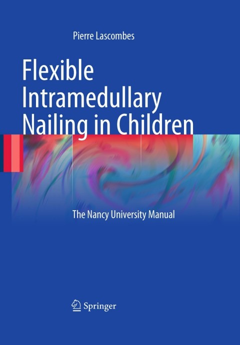 Cover image for book Flexible Intramedullary Nailing in Children