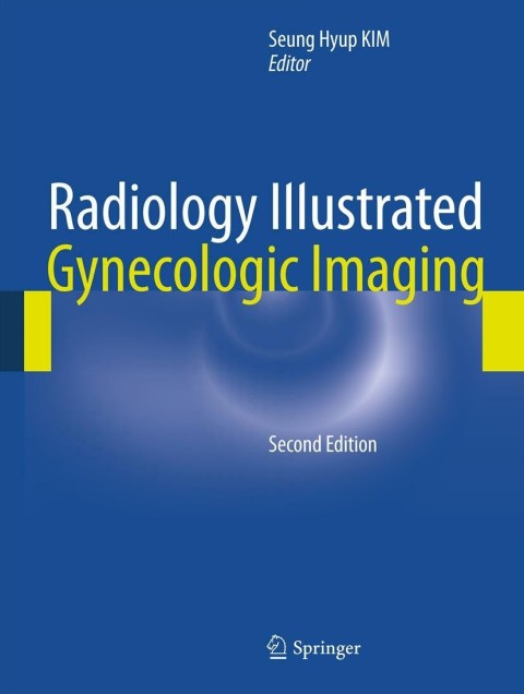 Cover image for book Radiology Illustrated: Gynecologic Imaging