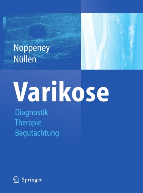 Cover image for book Varikose