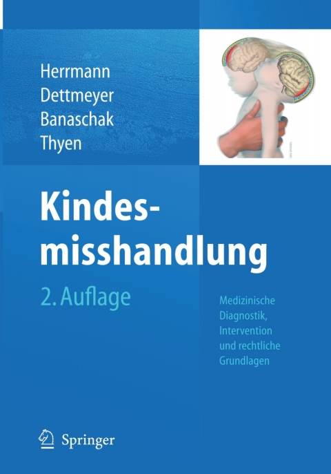 Cover image for book Kindesmisshandlung