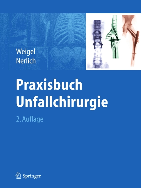 Cover image for book Praxisbuch Unfallchirurgie