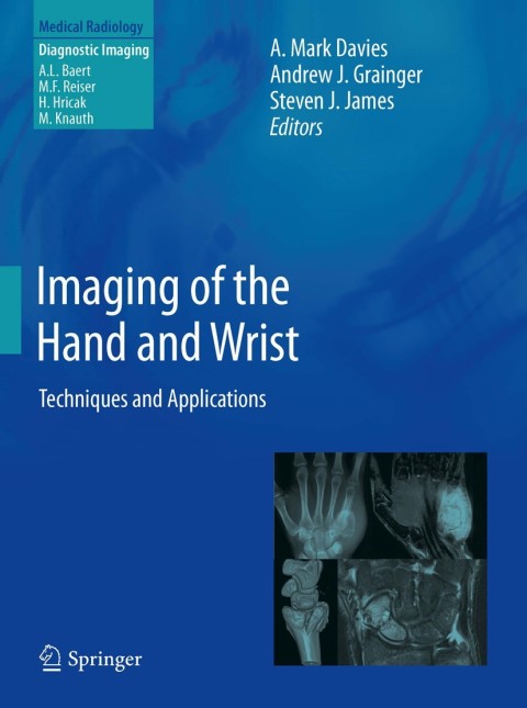 Cover image for book Imaging of the Hand and Wrist