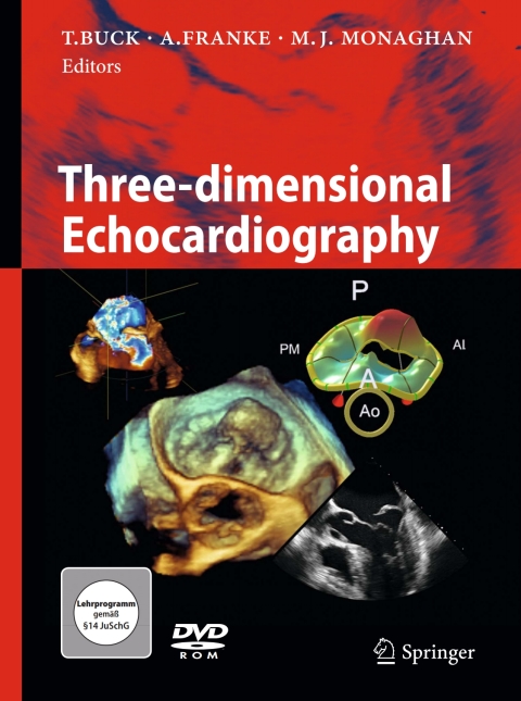 Cover image for book Three-dimensional Echocardiography