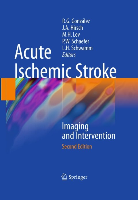 Cover image for book Acute Ischemic Stroke