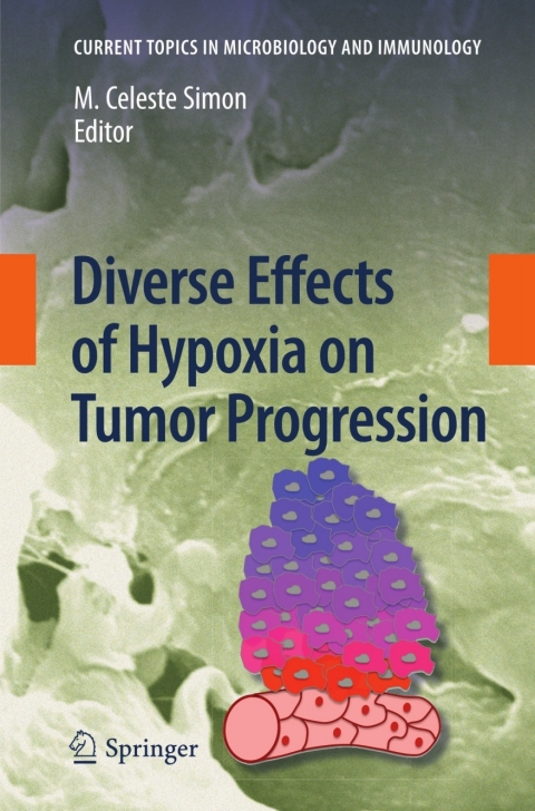 Cover image for book Diverse Effects of Hypoxia on Tumor Progression