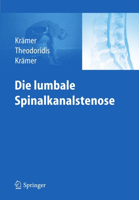 Cover image for book Die lumbale Spinalkanalstenose