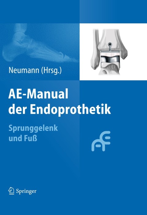 AE-Manual der Endoprothetik 