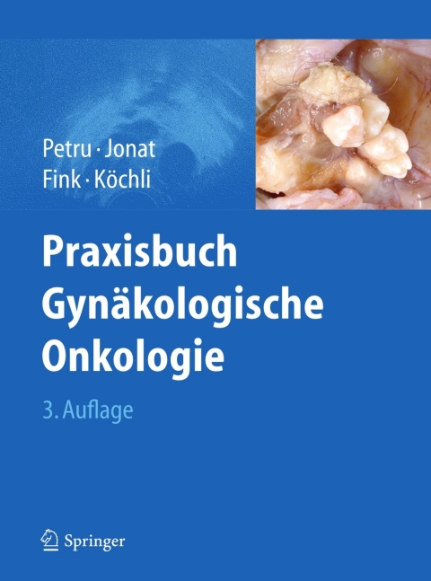 Cover image for book Praxisbuch Gynäkologische Onkologie