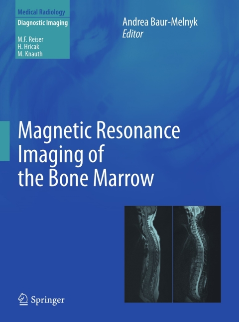 Magnetic Resonance Imaging of the Bone Marrow 