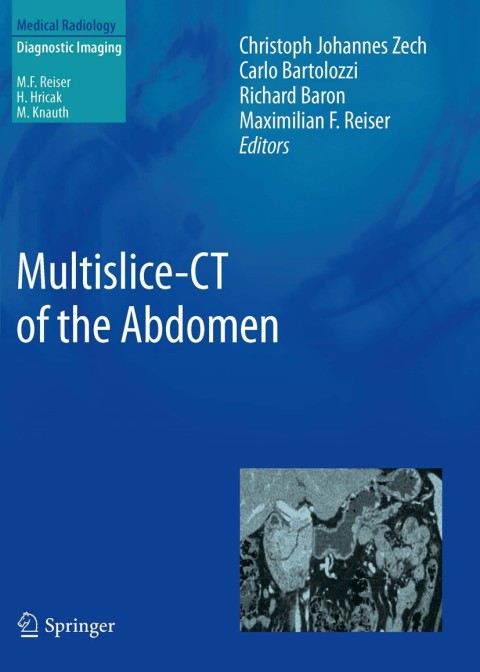 Cover image for book Multislice-CT of the Abdomen