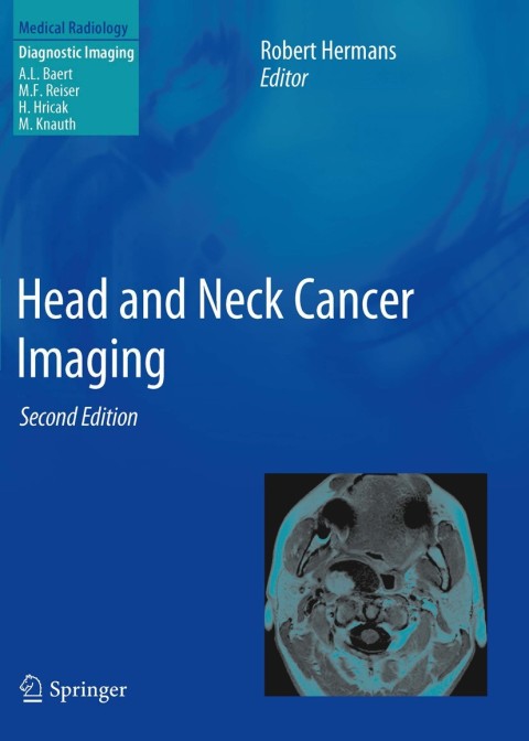 Cover image for book Head and Neck Cancer Imaging