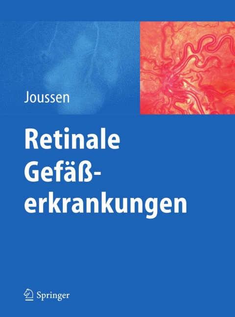 Cover image for book Retinale Gefäßerkrankungen
