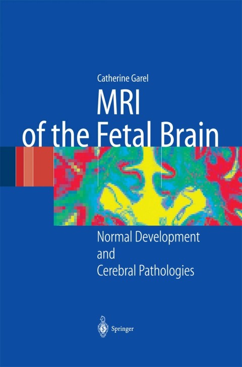 Cover image for book MRI of the Fetal Brain