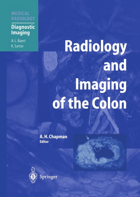 Cover image for book Radiology and Imaging of the Colon